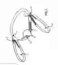 Fig. 05 - Pelvic and lumbar spine support