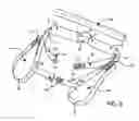 Fig. 06 - Pelvic and lumbar spine support