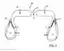 Fig. 07 - Pelvic and lumbar spine support