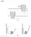 Fig. 13 - Device for organizing and maintaining the patency of lines