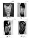 Fig. 06 - Systems and methods for personalizing prosthetic and orthotic devices