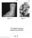 Fig. 07 - Systems and methods for personalizing prosthetic and orthotic devices