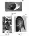Fig. 08 - Systems and methods for personalizing prosthetic and orthotic devices