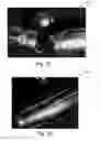 Fig. 09 - Systems and methods for personalizing prosthetic and orthotic devices