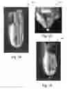 Fig. 10 - Systems and methods for personalizing prosthetic and orthotic devices