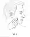 Fig. 05 - FACIAL BLEMISH REMOVING DEVICE