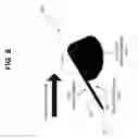 Fig. 07 - FACIAL BLEMISH REMOVING DEVICE