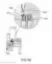Fig. 14 - Surgical cartridge wall expander