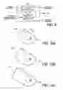 Fig. 07 - Extended field of view ultrasonic imaging with a two dimensional array probe