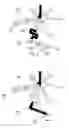 Fig. 05 - Microfluidic structure and method of measurement and/or positioning of a volume of a liquid