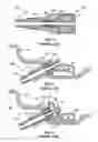 Fig. 03 - Tire valve fixing element