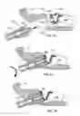 Fig. 09 - Tire valve fixing element