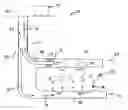 Fig. 01 - Downhole separation and reinjection
