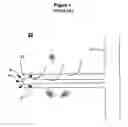Fig. 02 - Jet-drilling and completion process