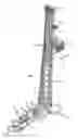 Fig. 01 - Guyless service rig with side-mounted, pivotally deployable rear outriggers