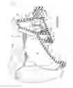 Fig. 06 - Fluid dispensing valve
