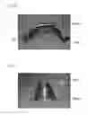 Fig. 14 - Method of blow molding a bulk metallic glass