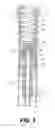 Fig. 04 - Spring suspension for a handlebar-steered vehicle