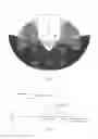 Fig. 04 - Radar sensor with frontal and lateral emission