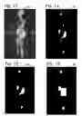 Fig. 07 - SURVEILLANCE WITH REANALYSIS OF SCREENING DATA