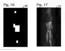 Fig. 08 - SURVEILLANCE WITH REANALYSIS OF SCREENING DATA