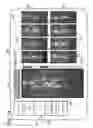 Fig. 09 - SURVEILLANCE WITH REANALYSIS OF SCREENING DATA