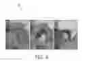 Fig. 07 - IMAGE PROCESSING