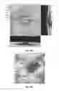 Fig. 03 - Diagnostic method and apparatus for predicting potential preserved visual acuity