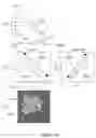 Fig. 16 - Method and system for four dimensional intensity modulated radiation therapy for motion compensated treatments