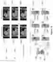 Fig. 20 - Method and system for four dimensional intensity modulated radiation therapy for motion compensated treatments