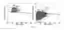 Fig. 09 - APPARATUS FOR STENOSIS ESTIMATION