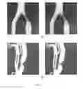 Fig. 20 - APPARATUS FOR STENOSIS ESTIMATION