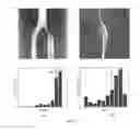 Fig. 22 - APPARATUS FOR STENOSIS ESTIMATION