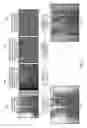 Fig. 03 - Fast Hysteresis Thresholding in Canny Edge Detection