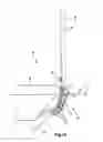 Fig. 03 - Pipeline guide assemblies