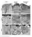 Fig. 01 - Elastin producing fibroblast formulations and methods of using the same