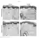 Fig. 06 - Elastin producing fibroblast formulations and methods of using the same