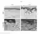 Fig. 08 - Elastin producing fibroblast formulations and methods of using the same