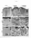 Fig. 09 - Elastin producing fibroblast formulations and methods of using the same