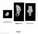 Fig. 05 - Molecular probe for imaging of pancreatic islets and use of the same
