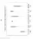 Fig. 02 - Biomarkers associated with nephropathy