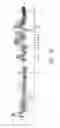 Fig. 25 - Thermostable reverse transcriptases and uses thereof