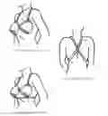 Fig. 03 - Gravity Bra