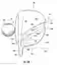 Fig. 20 - Golf club head with visual swing indicator