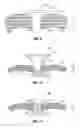 Fig. 09 - Universal height foam port
