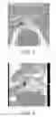 Fig. 06 - Method and system for performing biopsies