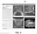 Fig. 07 - Method and system for performing biopsies