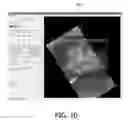 Fig. 08 - Method and system for performing biopsies