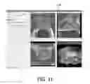 Fig. 09 - Method and system for performing biopsies