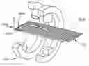 Fig. 01 - Method and apparatus for reducing malalignment of fractured bone fragments